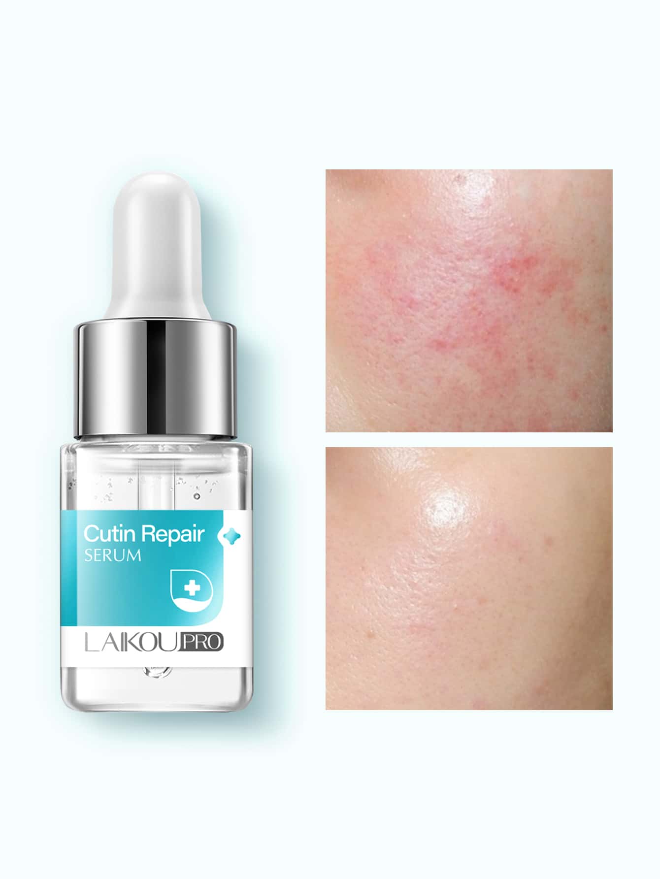 Shein- 12ML Cutin Repair Serum, 12 ml