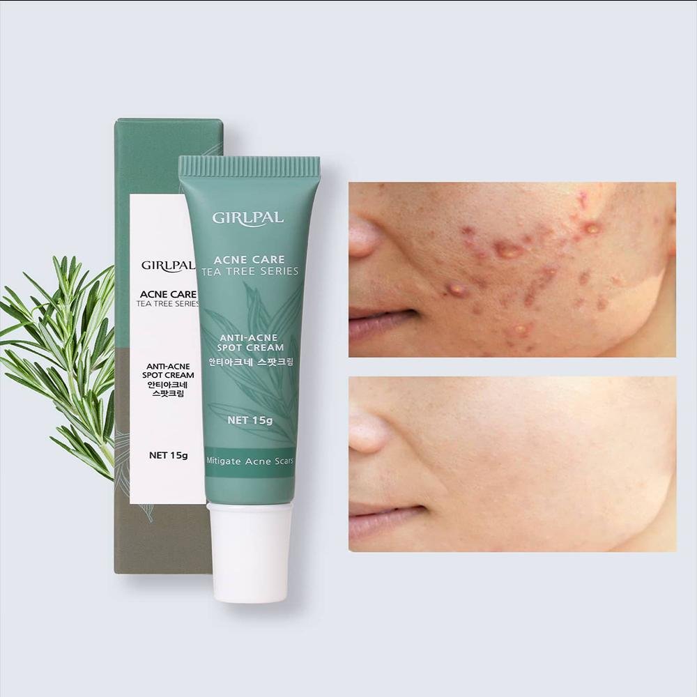 Shein- Brightening Anti-Acne Spot Cream, 15g